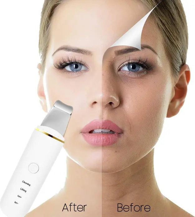 Curățător Ionic Ultrasonic 7C - Dispozitiv Facial 26kHz, 4 Funcții: Peeling, Micro-masaj, Iontoforeză, Baterie Reîncărcabilă USB, Spatulă din Oțel Inoxidabil
