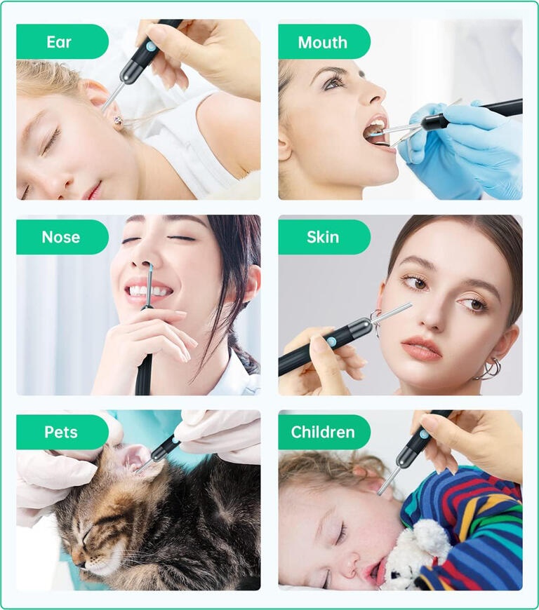 Y8 Ear Wax Removal Kit, Digital Otoscope with 2MP 1080P Camera, Wi-Fi Connection, IP67 Waterproof, CMOS Sensor, iOS and Android Compatible, Black